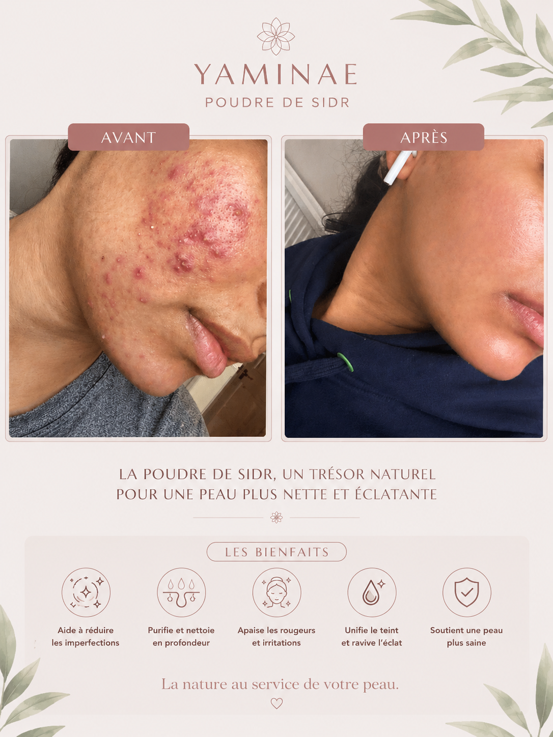 POUDRE DE SIDR — Soin Naturel Cheveux & Peau