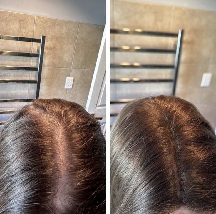 Huile Pousse & Masse capillaire