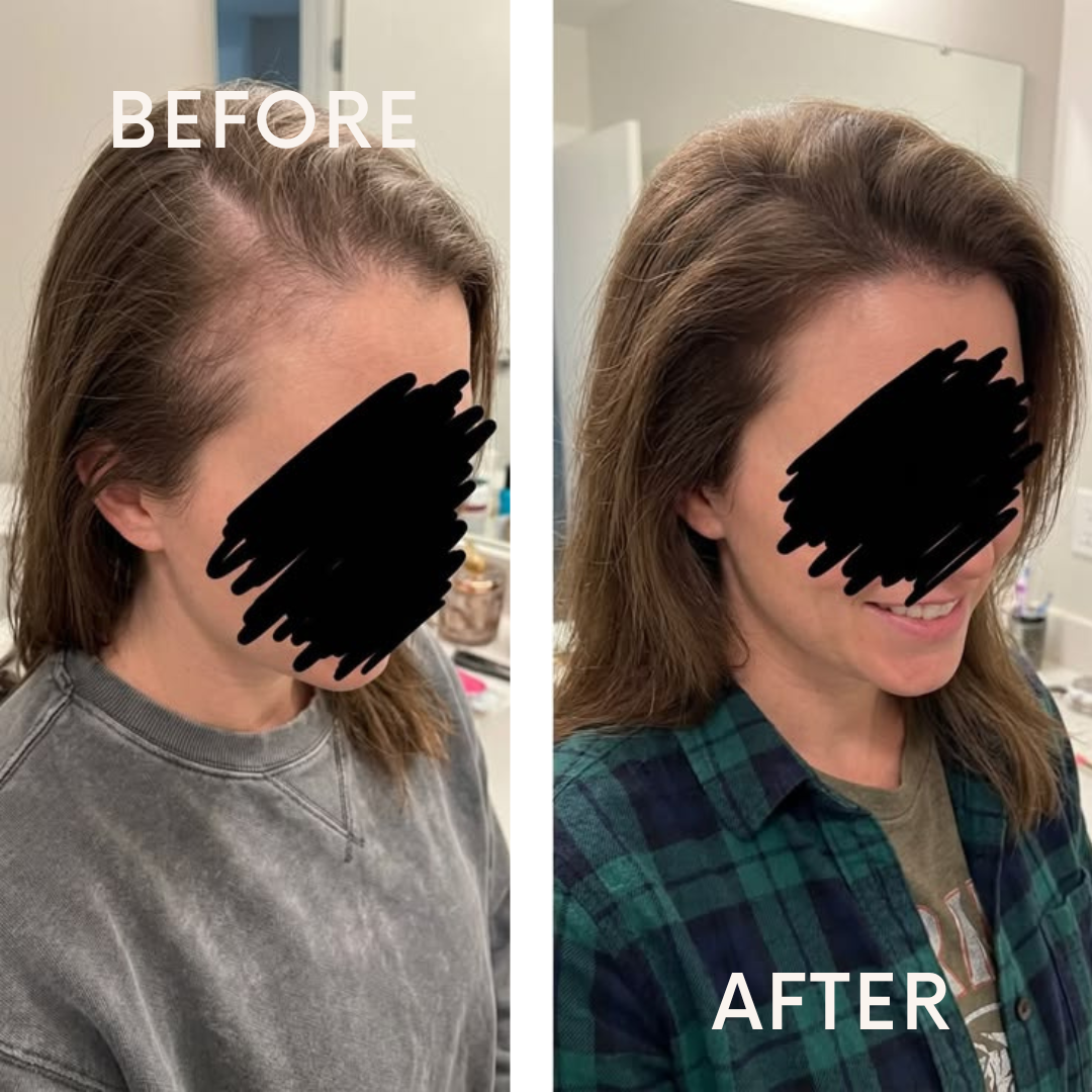 La Routine Anti-Chute Complète — Shampooing + Chantilly