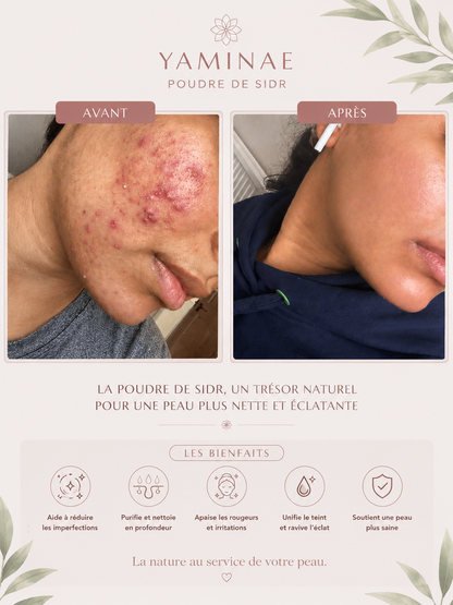 POUDRE DE SIDR — Soin Naturel Cheveux & Peau